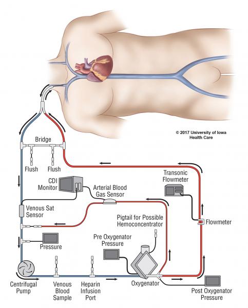 ecmo_figure2.jpg