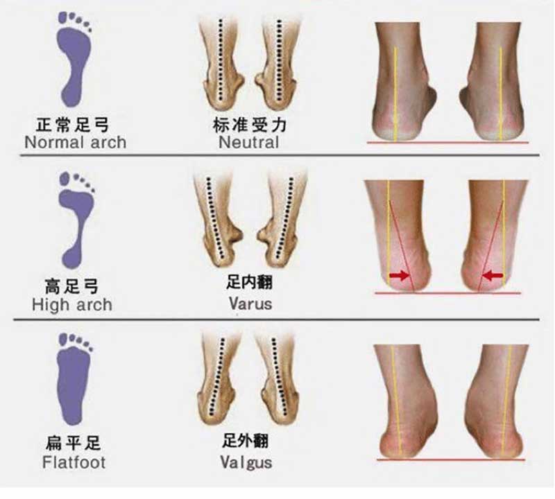 feet-types.jpg