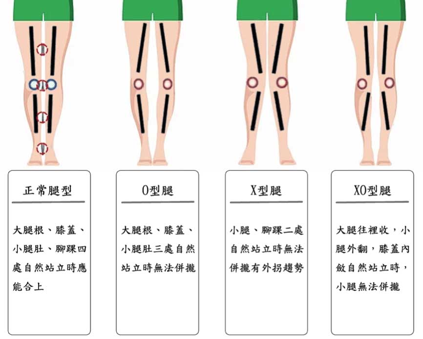 Leg-types.jpg